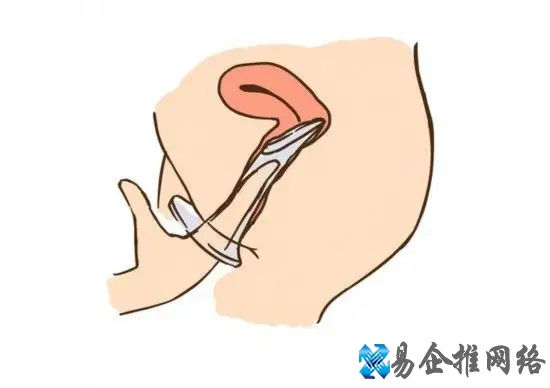 女用避孕套怎么用？真人演示女用避孕套佩戴过程