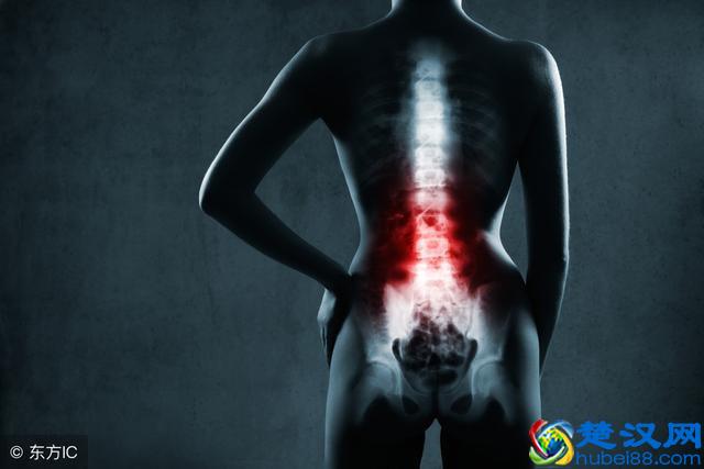 腰椎间盘突出自我疗法，平时就可以做，每天1次，腰突不复发