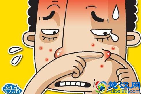 如何祛痘和痘印？教您最佳护理方法