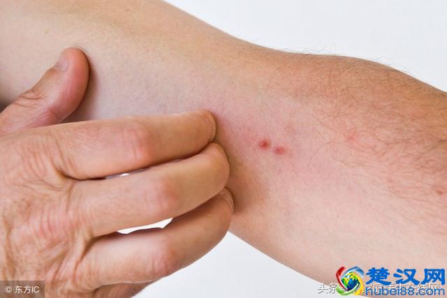 皮肤上莫名其妙起小疙瘩？可能是身体出现这6个毛病