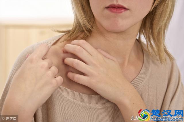 皮肤上莫名其妙起小疙瘩？可能是身体出现这6个毛病