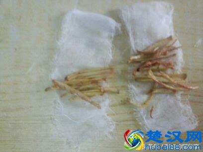 不吃药，治好宝宝打喷嚏流鼻涕，很实用，宝妈推荐