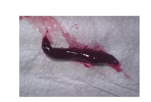 身为女人，你居然不知道大姨妈来的那几天，流出的血块是什么？