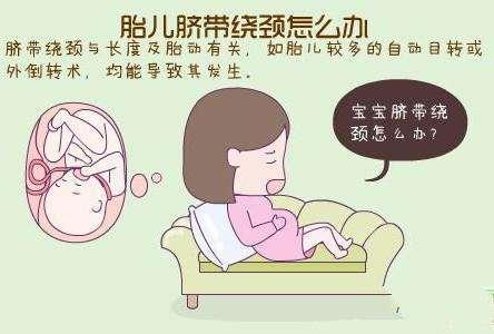 孕检查出脐带绕颈怎么办？别慌，孕妈妈知道这几点就够了