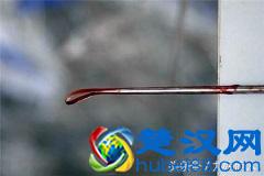 女性意外怀孕后，把握好做人流的最佳时间可以减小对身体的伤害！