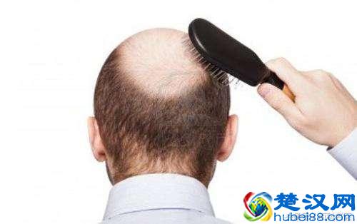 经常掉头发怎么办？4种方法教你告别脱发！