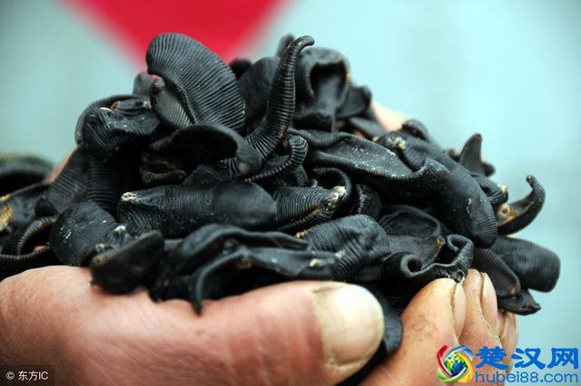 轻松解决静脉曲张，去掉腿上的“小蚯蚓”！