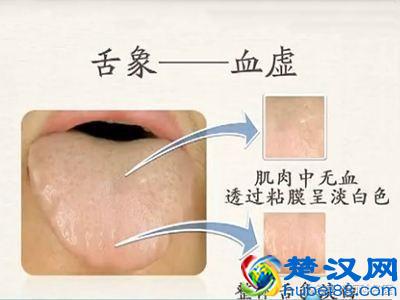 身体湿气重的5个信号，你中了几个？教你4招快速排湿！