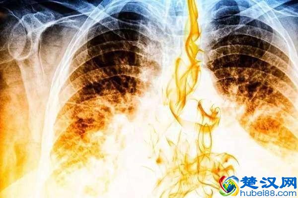 世界上最毒的物质，1克可以杀死1000万人，生活中居然很常见