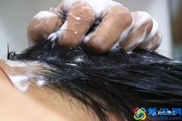 头顶上的头发少怎么办呢？告别秃顶从了解根源开始！