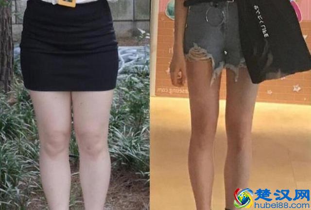 “腿粗”的女人，想要减肥瘦腿，希望你先改掉这3个“习惯”！