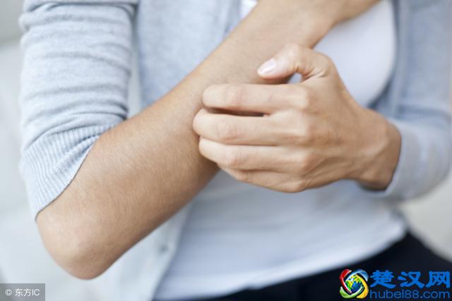 过敏后脸又红又痒，该怎么解决呢？按照这4点慢慢来