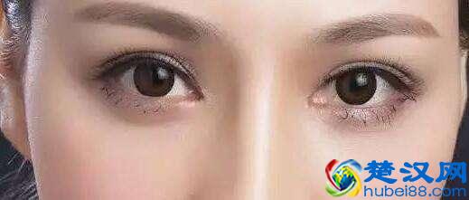 不做手术也能眼睛变大!坚持这3个小动作就好!