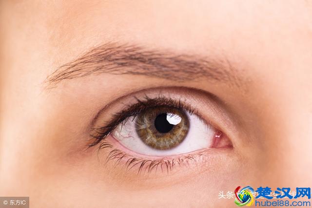 眼皮浮肿是怎么回事？三个可能性，第三个要深究