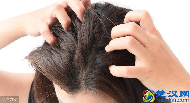 经常掉头发，可能是得了这6种疾病，做好3件事才能预防