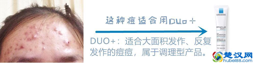 药妆只知道雅漾理肤泉？6大药妆品牌搞定所有肌肤问题！