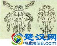 得了胃溃疡就吃这七种食物