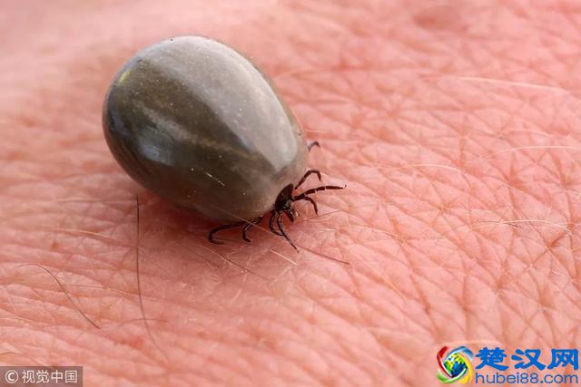 养肝护肝，多喝这6种茶！快告诉身边肝不好的人