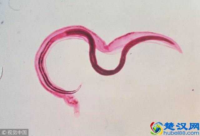 养肝护肝，多喝这6种茶！快告诉身边肝不好的人