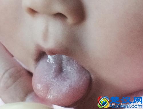 宝妈们你们知道宝宝舌苔发白的真正原因吗