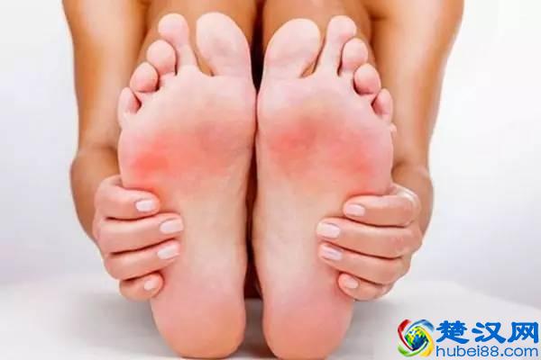 脚心痒是怎么回事？该怎么止痒？