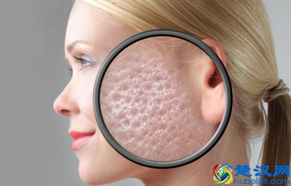 脸上有螨虫的人，要记住4个“天然除螨法”，把螨虫一点一点扼杀