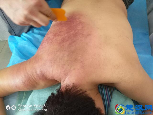 中医养生美容店为啥不好做？