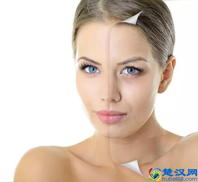 都知道枸杞好，可你真的知道每天吃多少？