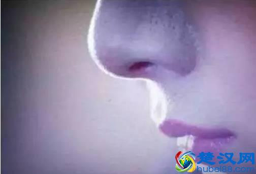 去除黑头的六种方法，到底哪种最有效？