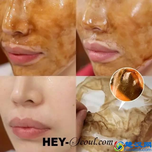 去除黑头的六种方法，到底哪种最有效？