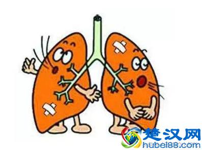 有些人一吃饭就爱出汗，特别是夏天，这是怎么回事呢？