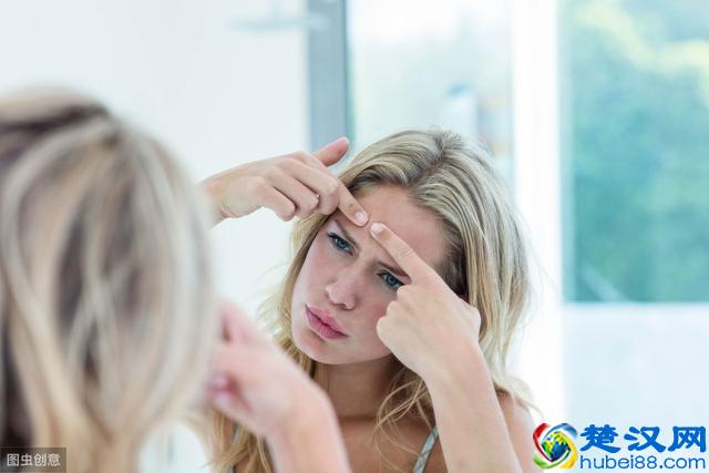 女生要如何预防痘痘，生活的小习惯很重要