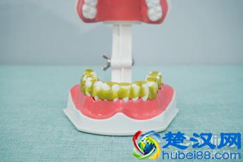 科学测试了9款100-500元电动牙刷，这几款好用最值得买