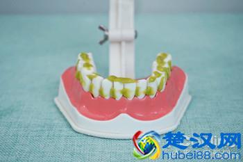 科学测试了9款100-500元电动牙刷，这几款好用最值得买