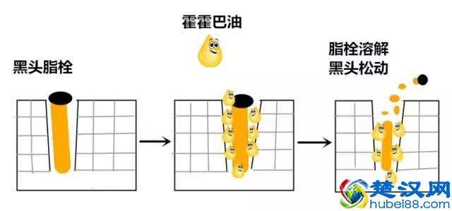 男生女生皮肤毛孔粗大有黑头怎么改善？