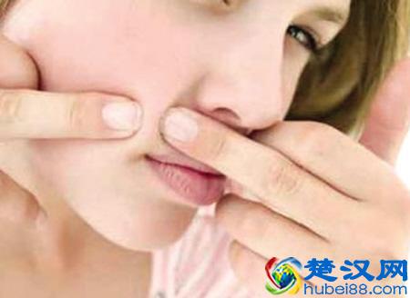 年轻人长青春痘，怎么消除！