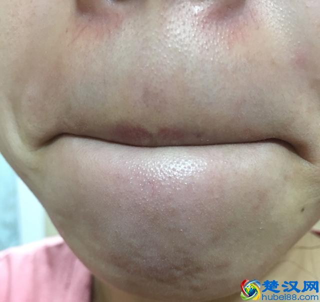 花印适合什么年龄，日本花印护肤品怎么样