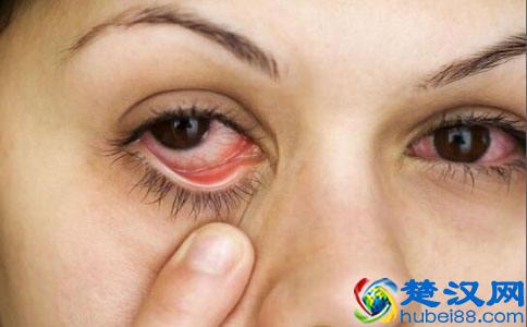 眼睛红血丝的真正原因，一共3个，你是哪一个