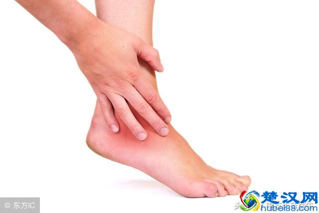 脚踝扭伤肿了怎么办？这样处理才能避免后患
