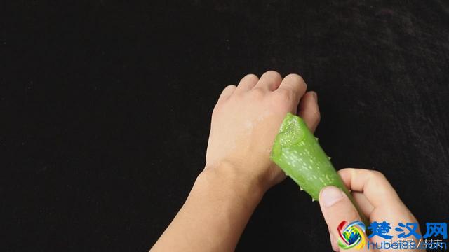 被烫伤了怎么办，只需用厨房常见的它，烫伤止痛快不起泡留疤