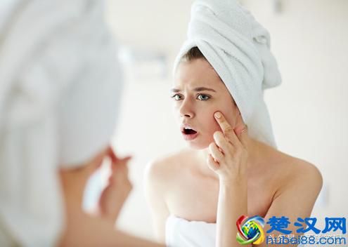 怎么消痘印最快小妙招：3个小妙招快速修复痘印