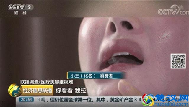 武汉整形美容医院网络形象4月榜发布，华美整形排名垫底