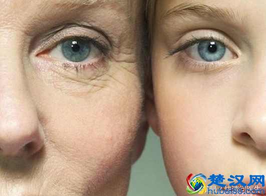 还在为眼角的鱼尾纹烦恼？这些经济适用消除鱼尾纹的方法拿去试试