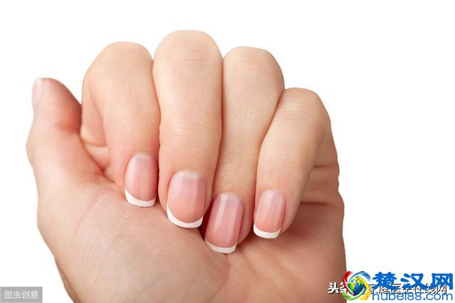 指甲有竖纹是怎么回事？总结6个原因，都要重视