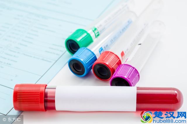 什么是nt检查？nt检查必须要做吗？千万不要觉得麻烦