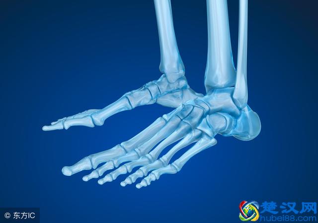 脚后跟疼是怎么回事？罪魁祸首可能是这5个，别大意了