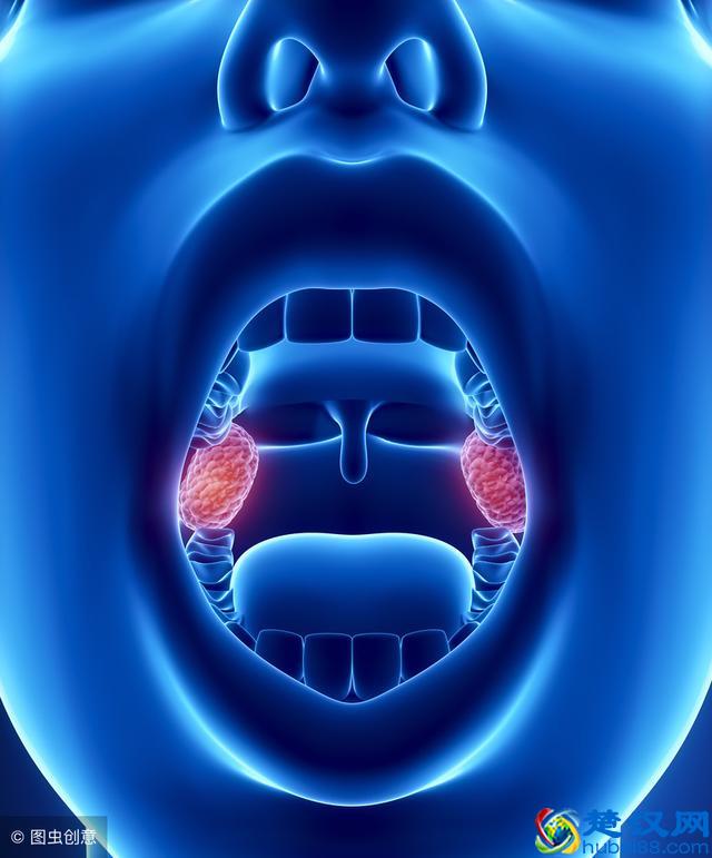 扁桃体发炎吃什么药？该如何吃呢？
