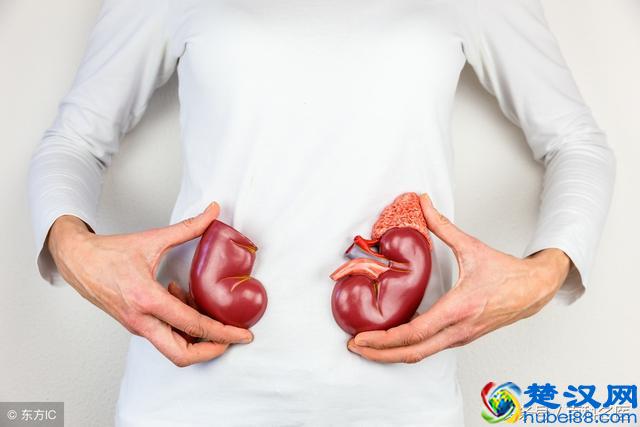 肾结石有哪些典型症状？被诊断为肾结石，吃什么药可以排石呢？