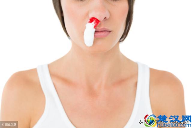 流鼻血是什么原因？中医认为：主要是身体有3个毛病