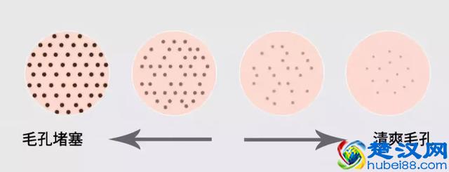 手欠的人请注意！皮肤科医生教你3招去黑头